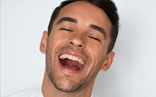 Composite Veneers SmileFast