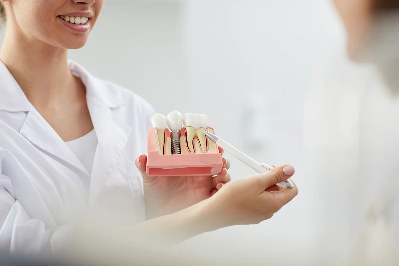 Dental Inplants